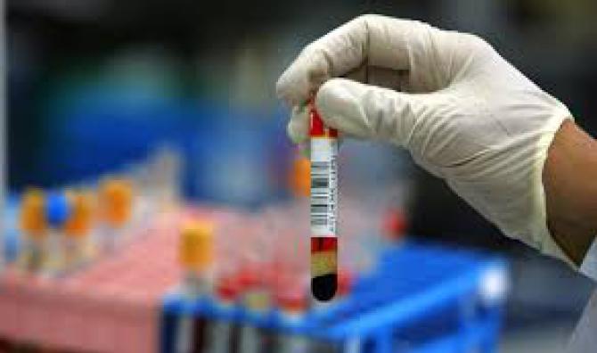 Esami di sangue e urine senza consenso, giovane automobilista “salvato” dal drugtest